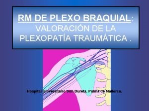 RM DE PLEXO BRAQUIAL VALORACIN DE LA PLEXOPATA