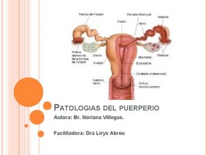 Subinvolucion del lecho placentario