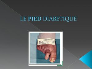 LE PIED DIABETIQUE Trop souvent ngligs les pieds