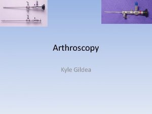 Arthroscopy Kyle Gildea What is Arthroscopy Non Invasive