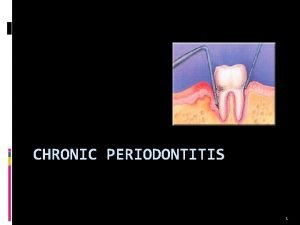 CHRONIC PERIODONTITIS 1 Definition Chronic Periodontitis can be