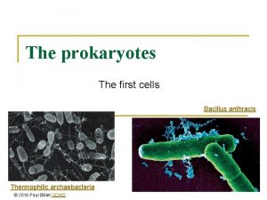 Bacillus anthracis prokaryotic or eukaryotic