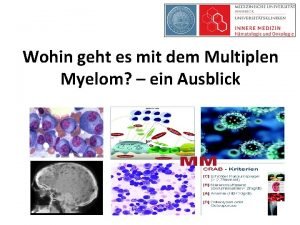 Wohin geht es mit dem Multiplen Myelom ein