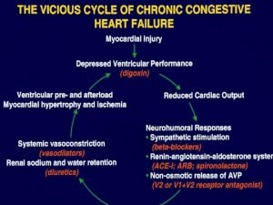 The Vicious Cycle of Chronic Congestive Heart Failure