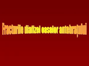 Clasificare n Fractura diafizar a ambelor oase 56