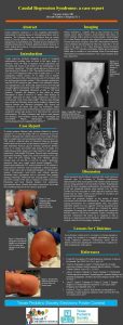 Caudal Regression Syndrome a case report Veronica Goitia