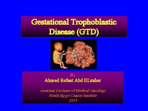 Gestational Trophoblastic Disease GTD By Ahmed Refaat Abd