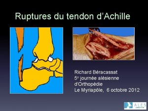 Ruptures du tendon dAchille Richard Bracassat 5 e