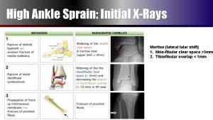 West point ankle sprain grading system