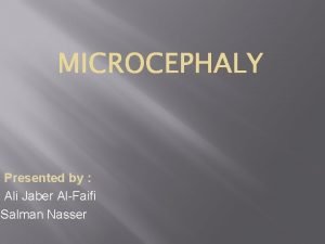 Presented by Ali Jaber AlFaifi Salman Nasser Microcephaly