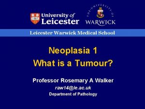 Leicester Warwick Medical School Neoplasia 1 What is