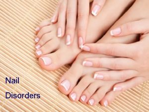 Nail Disorders To give clients professional and responsible