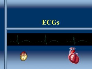 ECGs Arrhythmias Abnormal cardiac rhythms Prompt assessment of