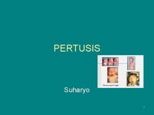 PERTUSIS Suharyo 1 Pendahuluan Penyakit infeksi pernafasan akut