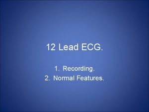 Ekg normal 12 lead