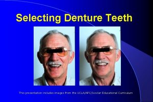 Denture teeth selection