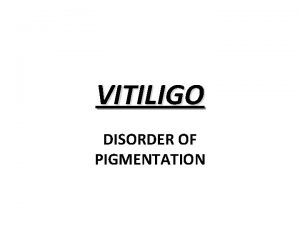 VITILIGO DISORDER OF PIGMENTATION ETIOLOGY GENETIC 20 30