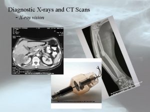 Diagnostic Xrays and CT Scans Xray vision http