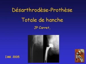 DsarthrodseProthse Totale de hanche JP Carret IMK 2005