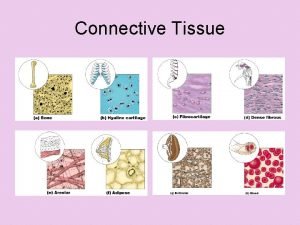 Connective Tissue General Characteristics most abundant and widely