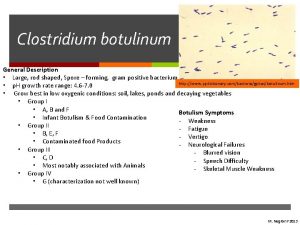 Clostridium botulinum General Description Large rod shaped Spore