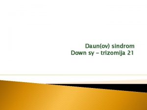 Daunov sindrom Down sy trizomija 21 Daun sindrom