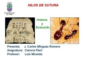 HILOS DE SUTURA Historia y Evolucin Presenta J