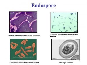 Endospore rosse allinterno del Bacillus megaterium C lostridium