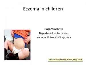 Eczema in children Hugo Van Bever Department of