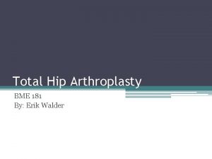 Total Hip Arthroplasty BME 181 By Erik Walder
