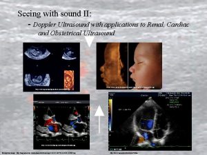 Seeing with sound II Doppler Ultrasound with applications