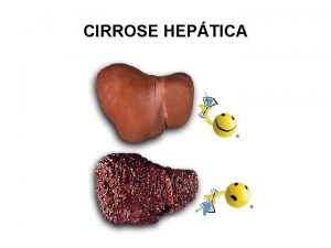 CIRROSE HEPTICA CIRROSE HEPTICA ETIOLOGIA Causas mais frequentes