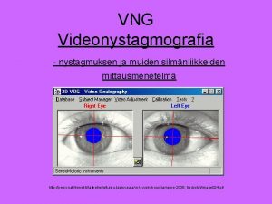 VNG Videonystagmografia nystagmuksen ja muiden silmnliikkeiden mittausmenetelm http