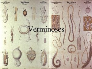 Verminoses Verminoses Doenas causadas por animais que apresentam