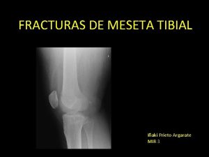 FRACTURAS DE MESETA TIBIAL Iaki Prieto Argarate MIR