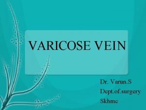 VARICOSE VEIN Dr Varun S Dept of surgery