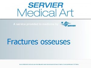 A service provided to medicine by Fractures osseuses