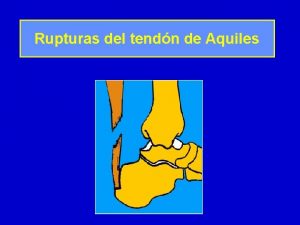 Rupturas del tendn de Aquiles En la mayor