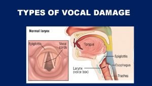 Permanently damaged vocal cords
