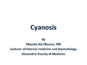 Cyanosis By Mayada Aly Moussa MD Lecturer of