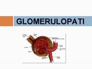 GLOMERULOPATI Glomerulopati Glomerulonefritis Proses inflamasi pada glomeruli dengan