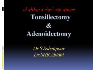 Features of adenoid facies