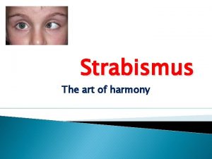 Strabismus The art of harmony Extraocular muscles Remember