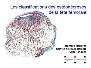 Les classifications des ostoncroses de la tte fmorale