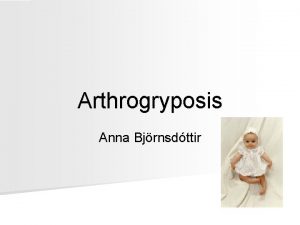 Arthrogryposis Anna Bjrnsdttir Arthrogryposis Mennen U et al