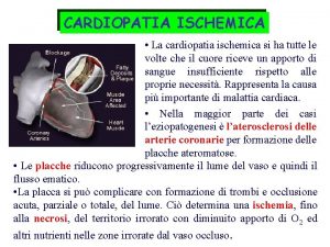 CARDIOPATIA ISCHEMICA La cardiopatia ischemica si ha tutte