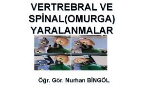 VERTREBRAL VE SPNALOMURGA YARALANMALAR r Gr Nurhan BNGL