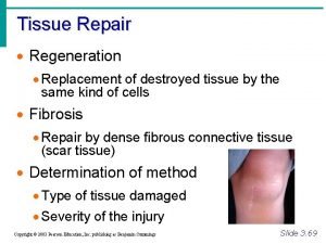 Replacement of destroyed tissue by the same kind of cells