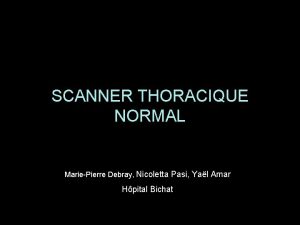 SCANNER THORACIQUE NORMAL MariePierre Debray Nicoletta Pasi Yal