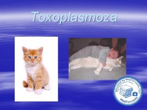 Toxoplasmoza